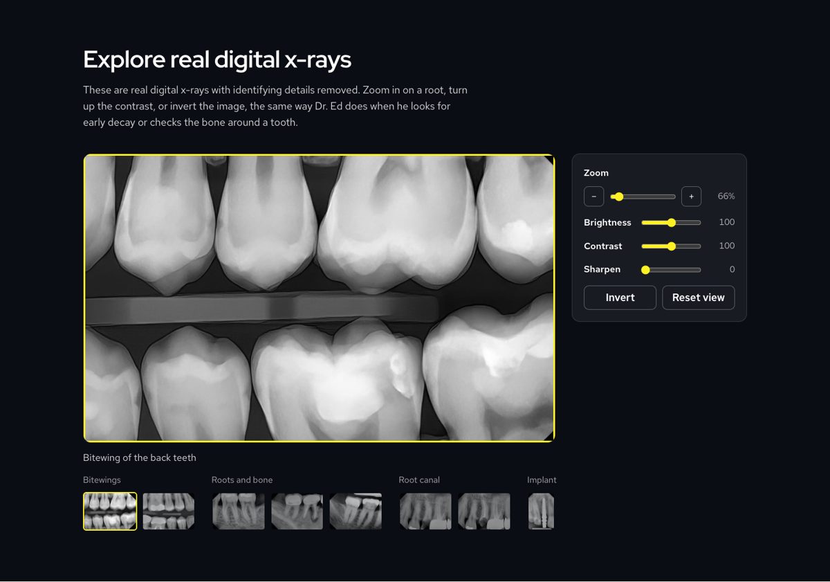 The interactive x-ray viewer with zoom, brightness, contrast and sharpen controls